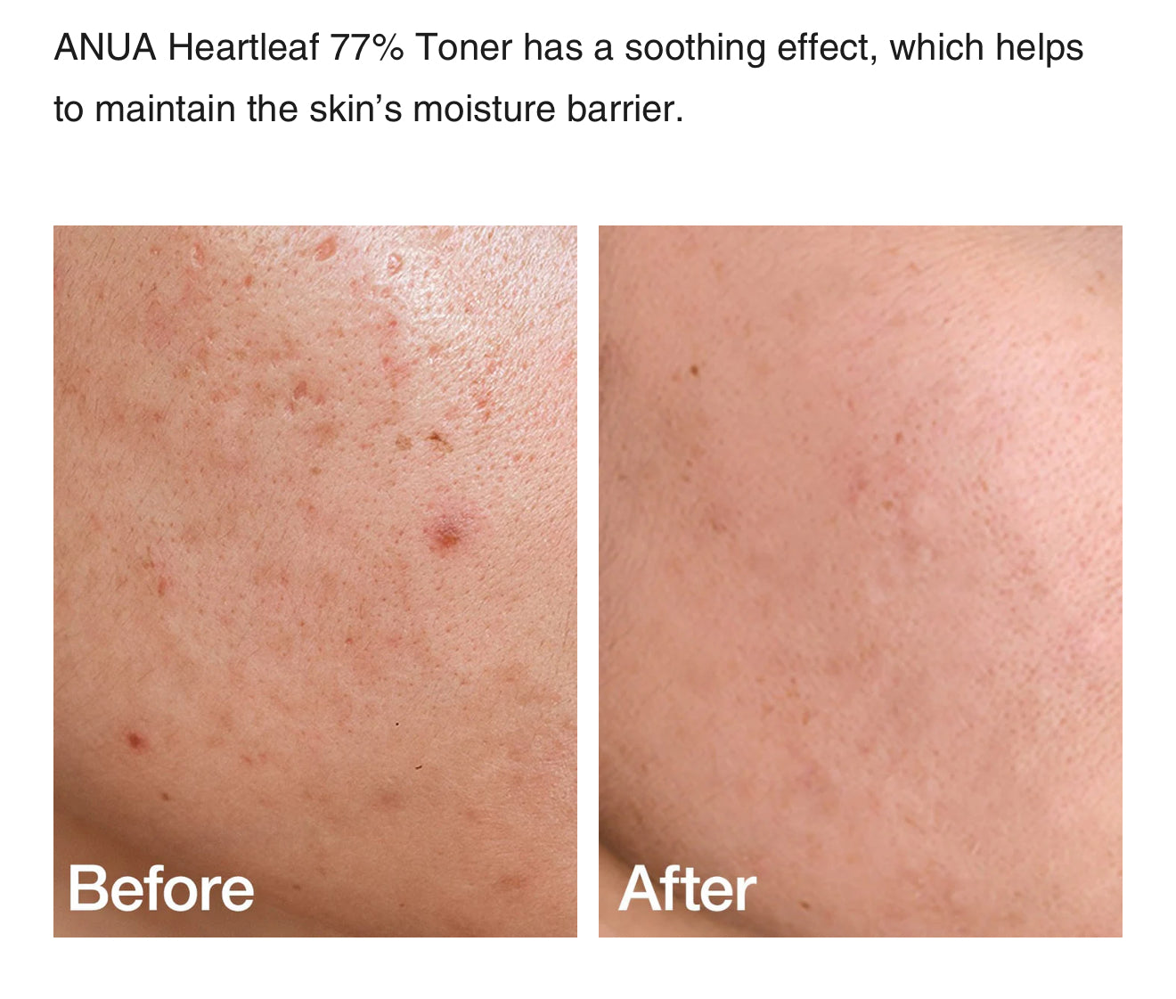 Anua - Heartleaf 77% Soothing Toner - 250 ml