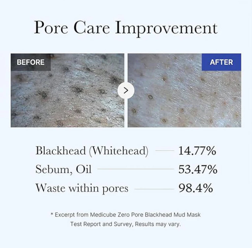 Medicube - Zero Pore Blackhead Mud Mask - 100 g | Mascarilla Purificante para Poros y Puntos Negros