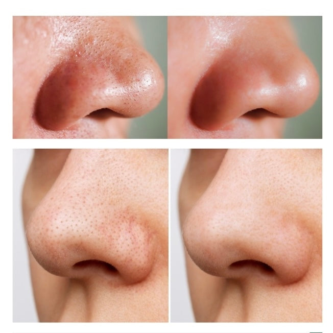 ANUA - Heartleaf Pore Control Cleansing Oil Mild - 200ml | Aceite Limpiador Elimina Sebo Impurezas