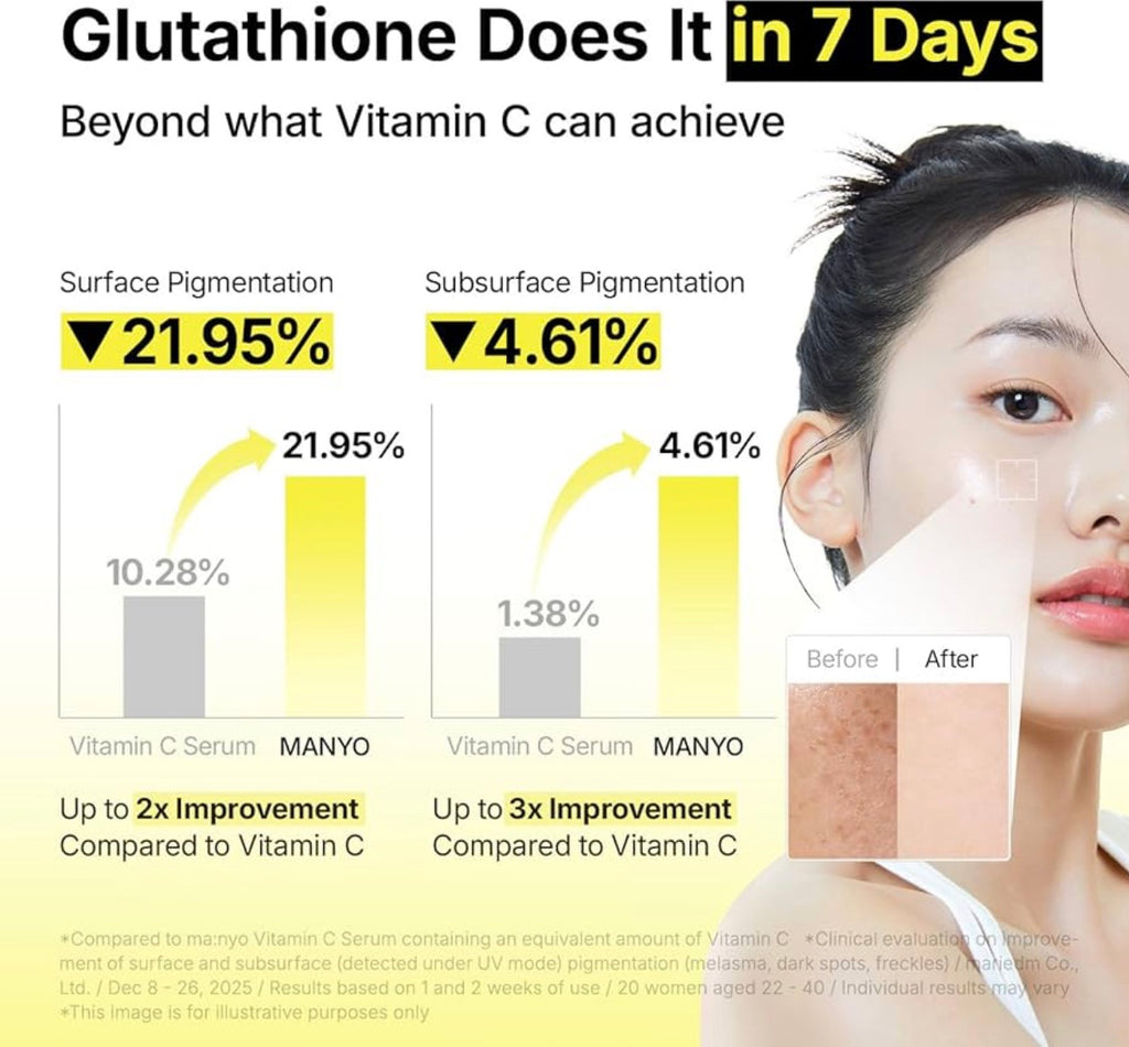 ma:nyo - Glutathione 7 Dark Spot Serum - 30ml | Suero Despigmentante E Iluminador Para Corregir Manchas Y Unificar El Tono