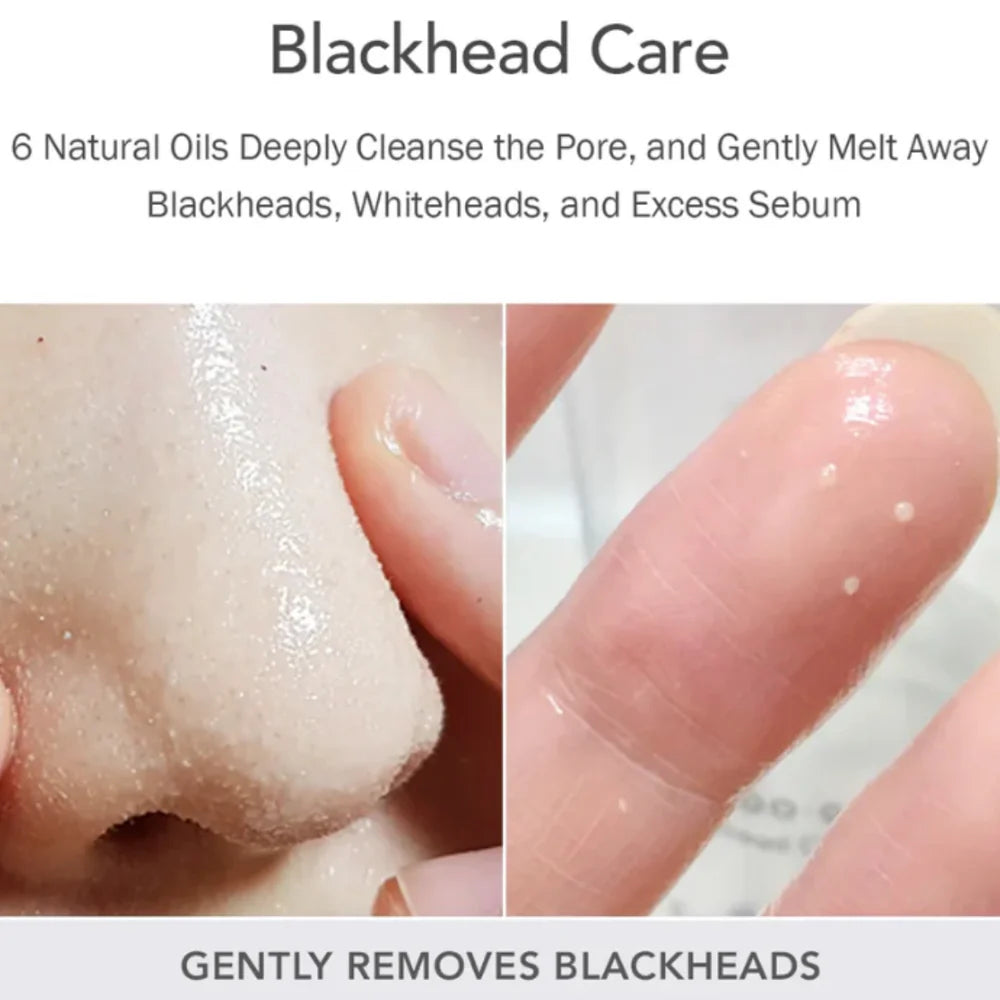 CELIMAX - Derma Nature Fresh Blackhead Jojoba Cleansing Oil - 150 ml