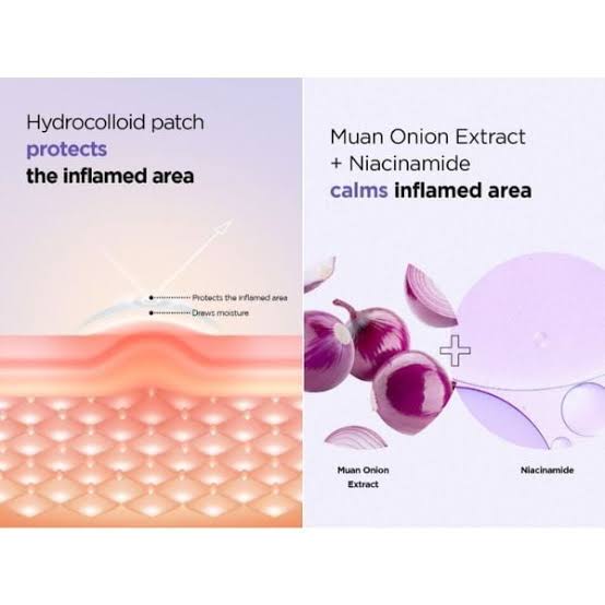 ISNTREE - Onion Newpair Spot Patch - (10mm x 12pz / 12mm x 12pz) | Parches Antiacné Calmantes con 24 Parches en Dos Tamaños (10mm y 12mm)