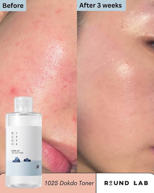 Round Lab - 1025 Dokdo Toner - 100ml | Tónico Facial Hidratante y Calmante