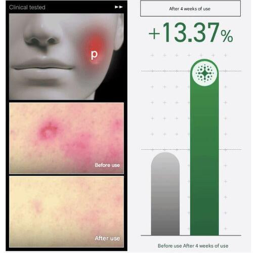 Anua - Heartleaf Centella Red Spot Cream (Crema para manchas rojas) - 30 gr