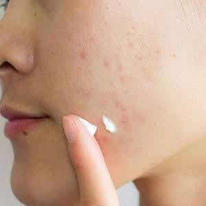 SKIN 1004 - Madagascar Centella Tea-Trica Spot Cream - 20ml