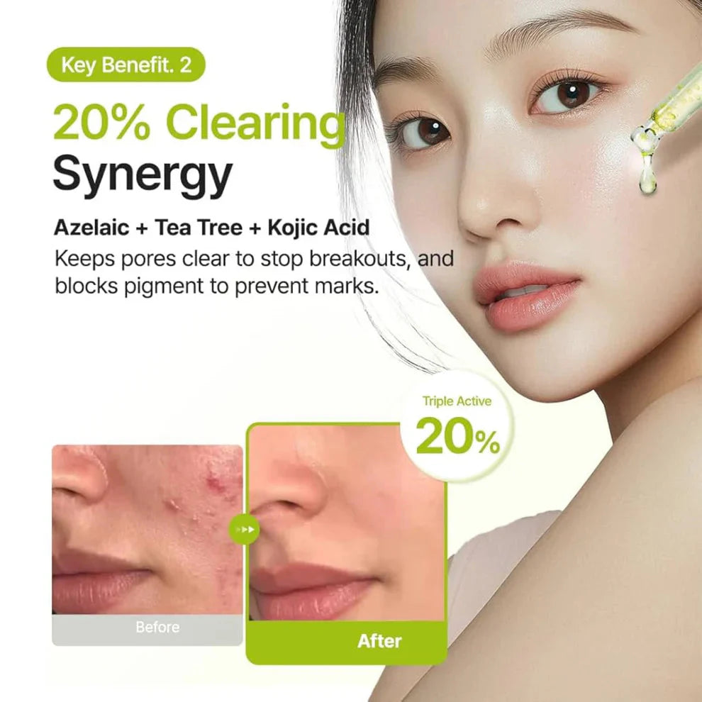 PURITO SEOUL - Azelaic Acid 10 Kojic Tea Tree Serum - 30ml | Sérum Despigmentante, Antiacné y Calmante con Ácido Azelaico, Kójico y Tea Tree