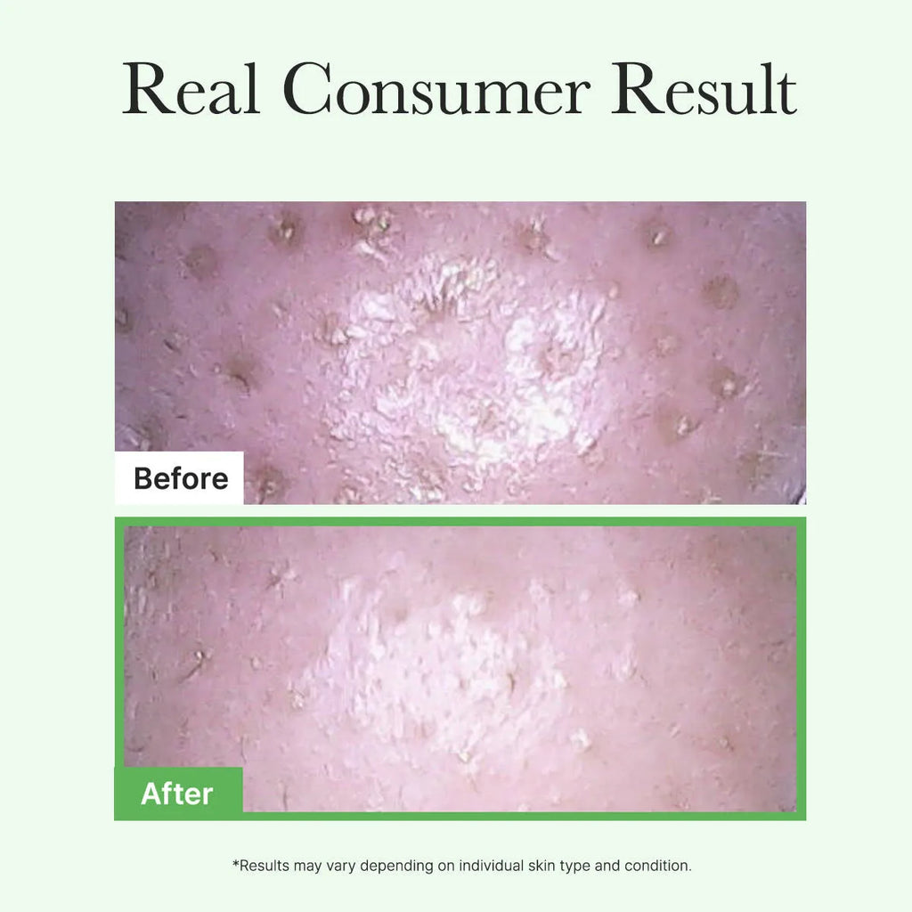 Arencia - Pore Melt Mochi Cleansing Oil - 200ml | Aceite Limpiador Profundo que Remueve Impurezas y Exceso de Sebo