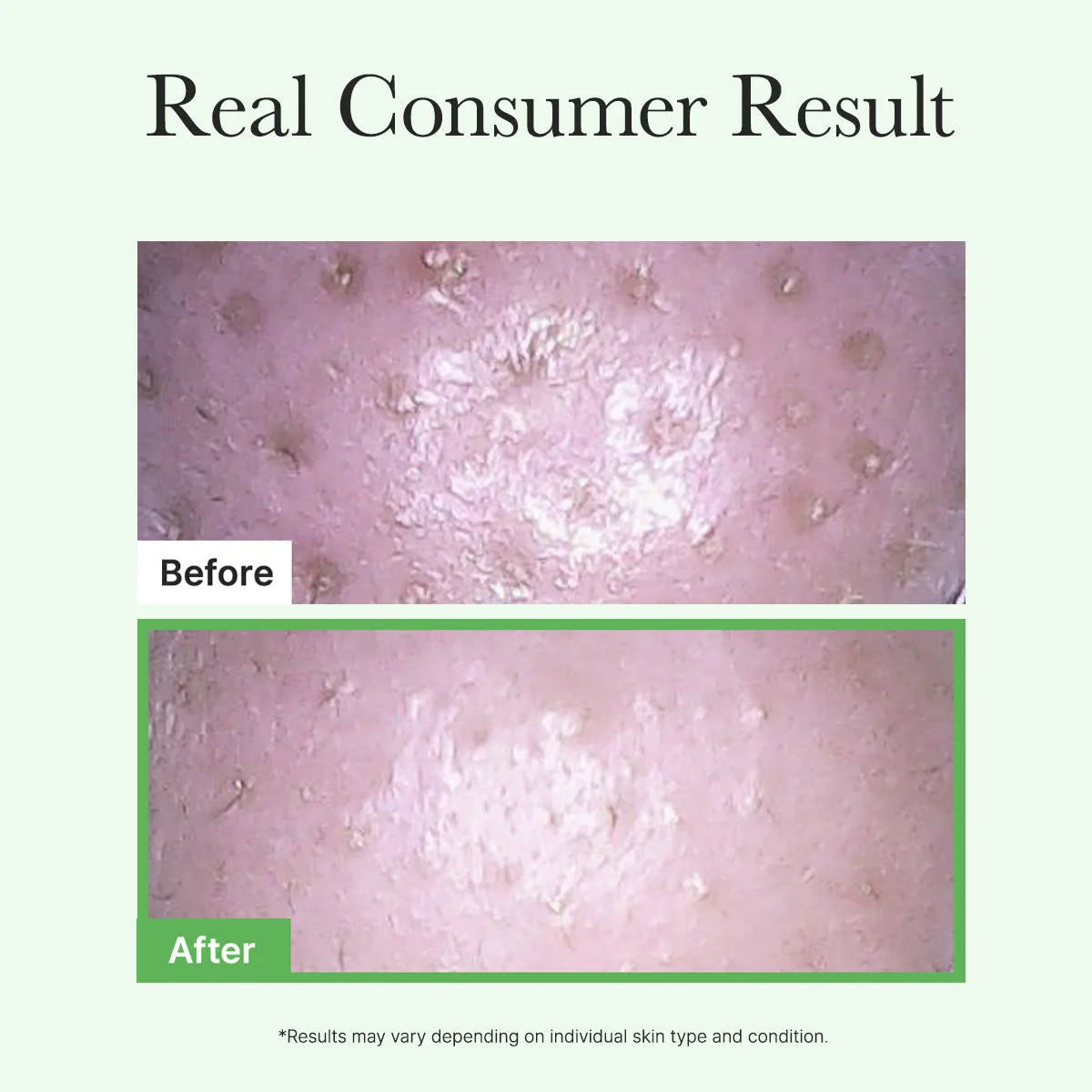 Arencia - Pore Melt Mochi Cleansing Oil - 200ml | Aceite Limpiador Profundo que Remueve Impurezas y Exceso de Sebo