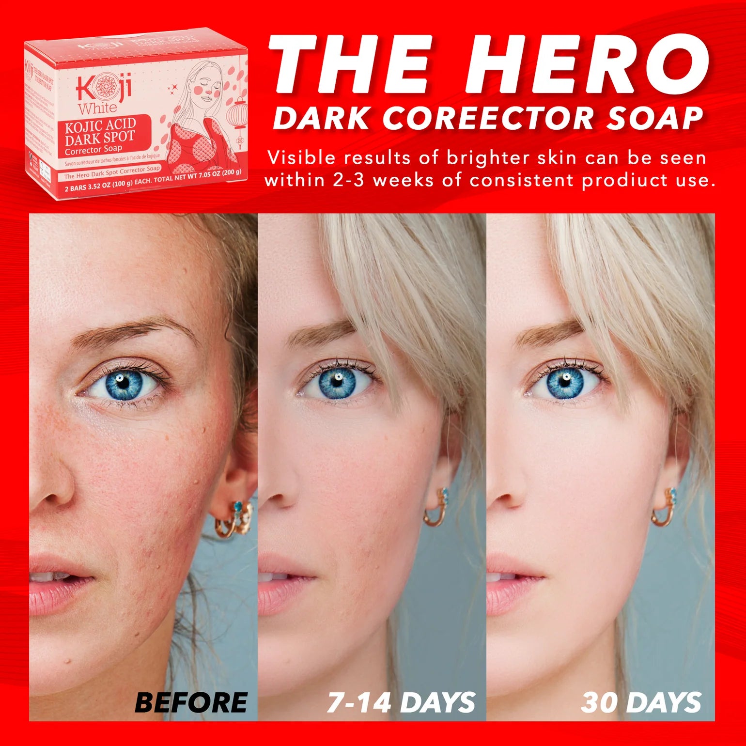 Koji White - Kojic Acid Skin Brightening Soap (2 Bars) | Jabón Iluminador y Despigmentante con Ácido Kójico