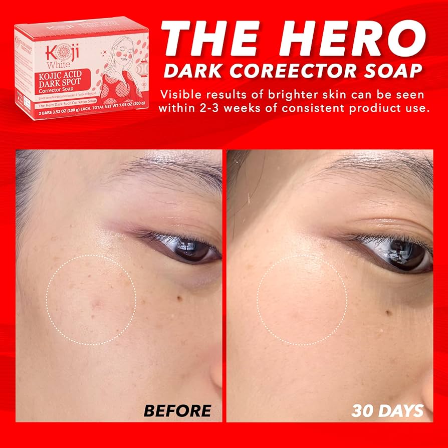 Koji White - Kojic Acid Skin Brightening Soap (2 Bars) | Jabón Iluminador y Despigmentante con Ácido Kójico