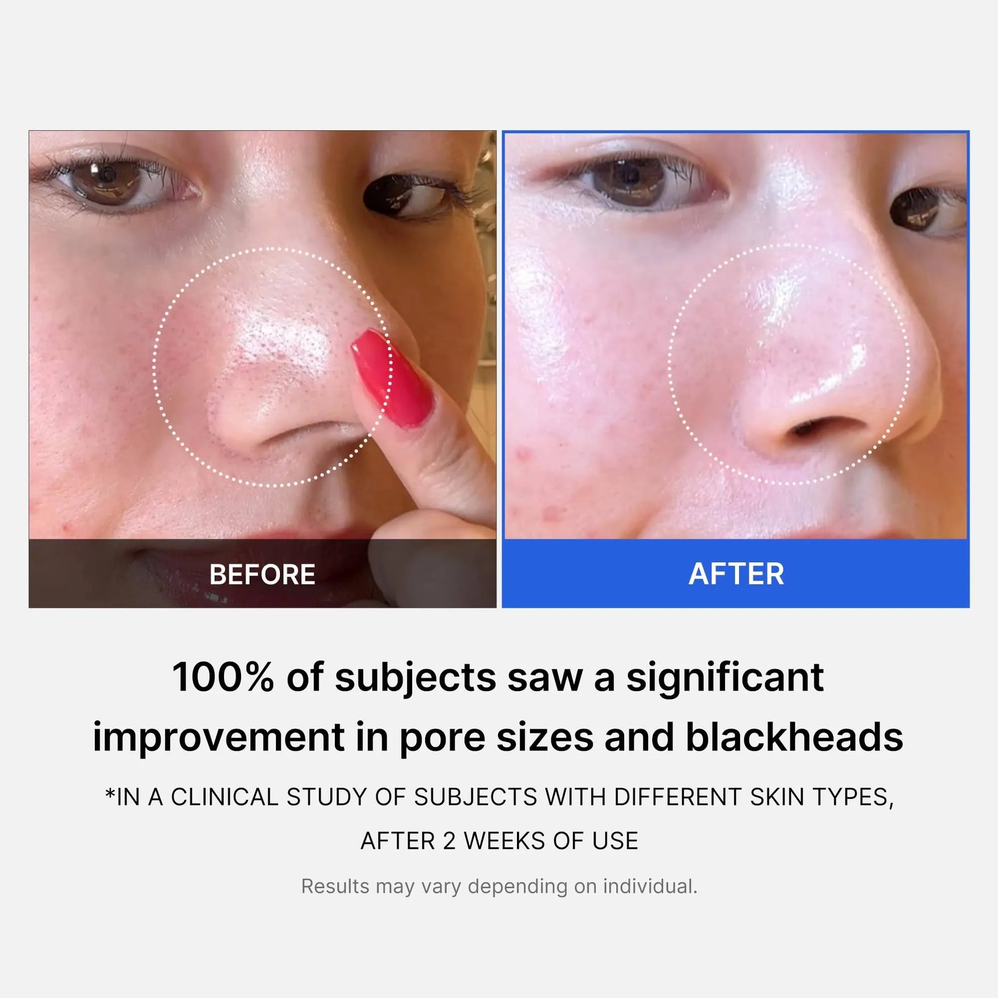 Medicube - Zero Pore Pad 2.0 - 70 pads | Almohadillas Exfoliantes que Reducen Poros y Mejoran la Textura