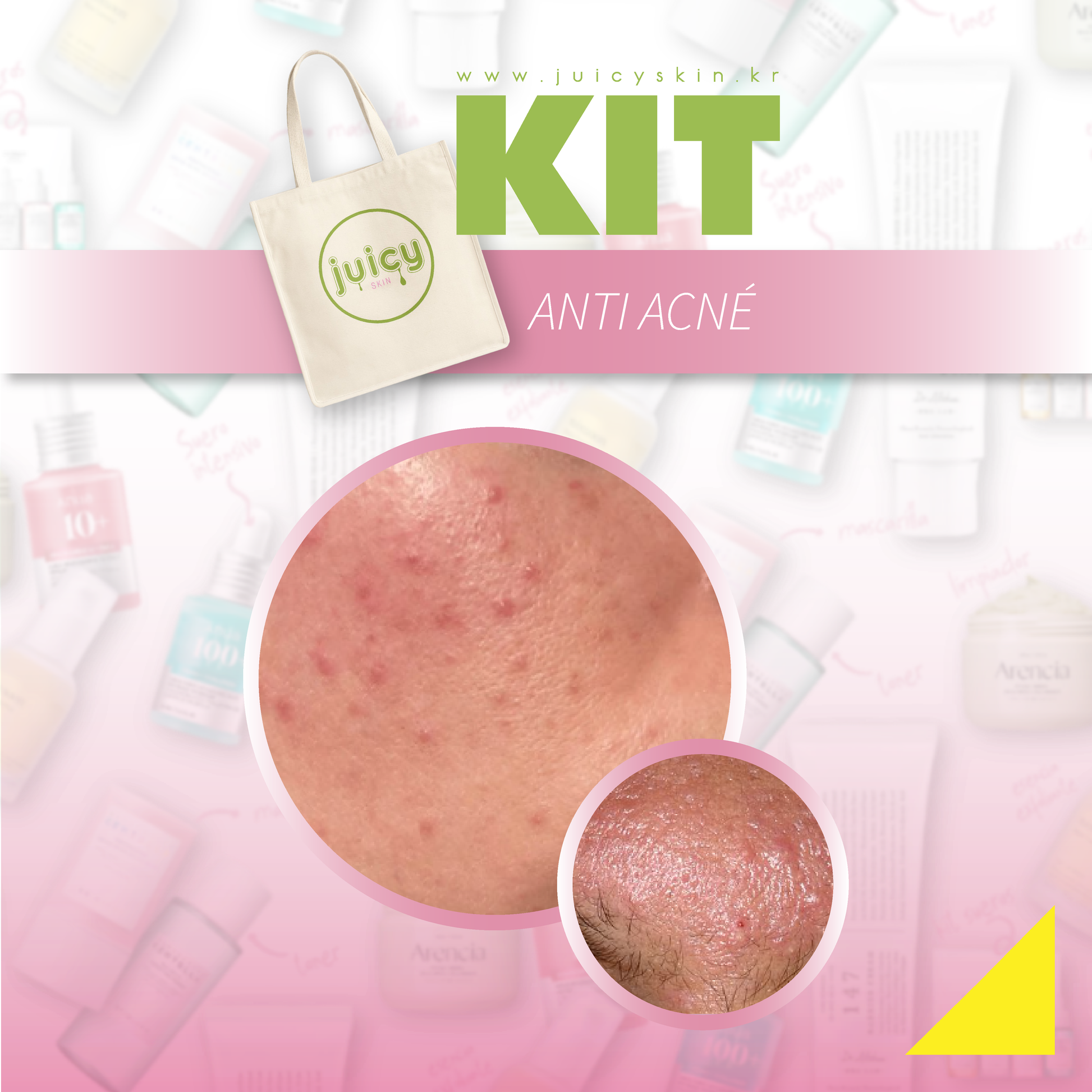 Kit Anti Acné | Purifica, Controla Brotes y Calma la Piel - 4 piezas