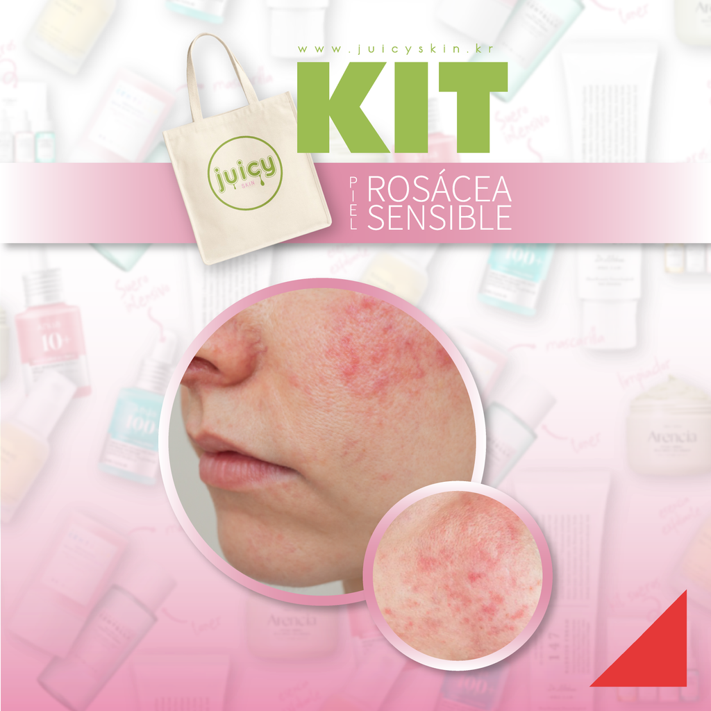 Kit Piel Sensible o con Rosácea | Hidratación, Reparación y Barrera Fortalecida - 4 piezas